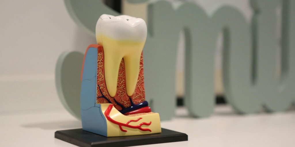 avulsione dente estrazione denti dentista migliore milano